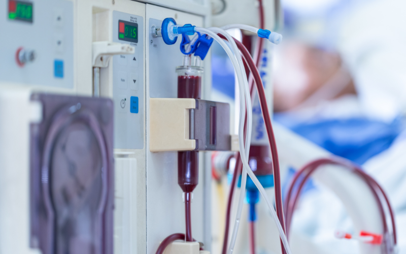 Dialysis Dialysis